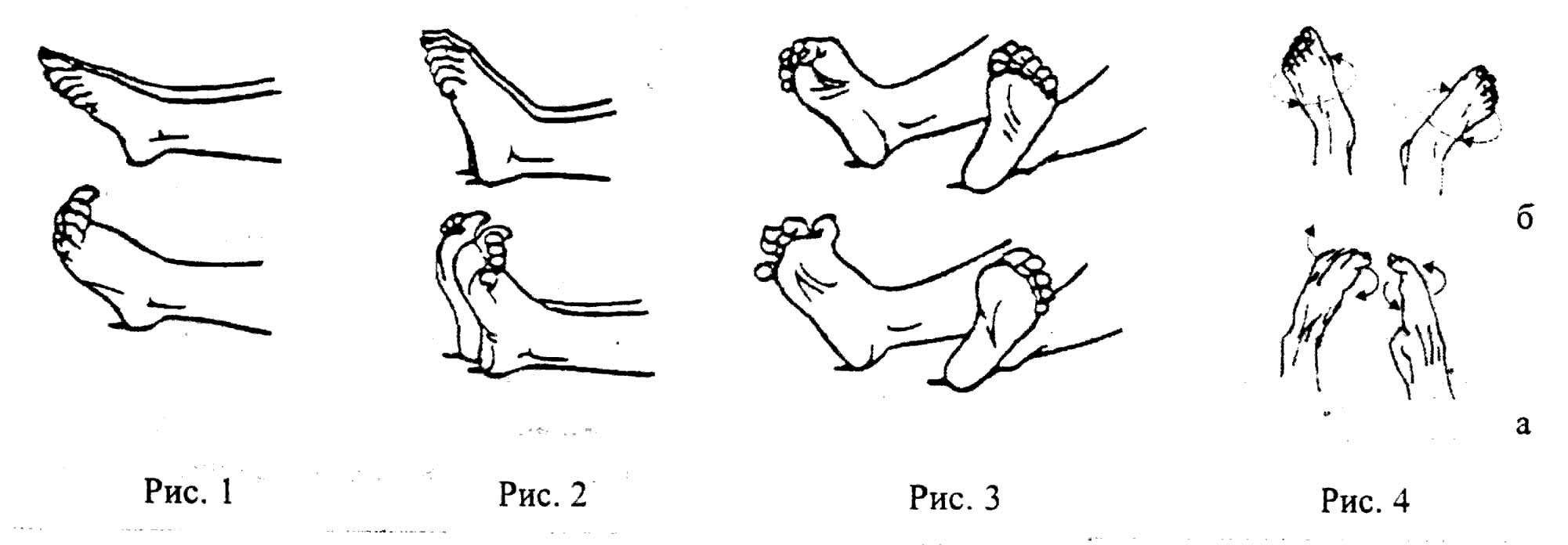 Упражнения для лечения плоскостопия 5 отличных комплексов. Типы плоскостопия