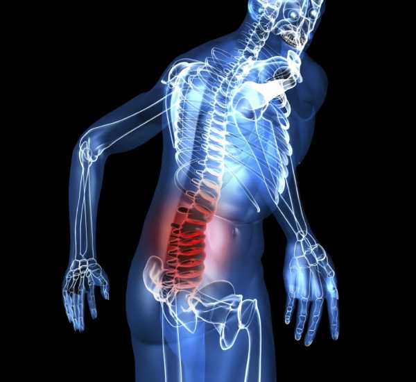 Артроз спины или позвоночника, поясничного отдела и межпозвоночных суставов