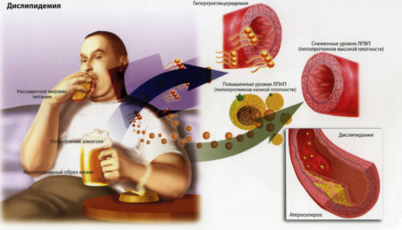 Принципы лечебного голодания при гипертонии – эффективный способ снижения артериального давления