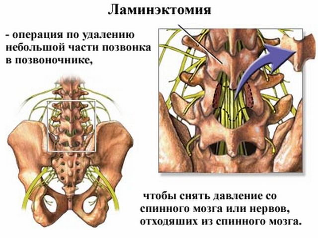 9 видов травм и болезней спинного мозга лечение и диагностика