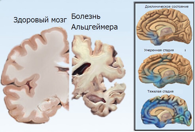 Как выглядит мозг