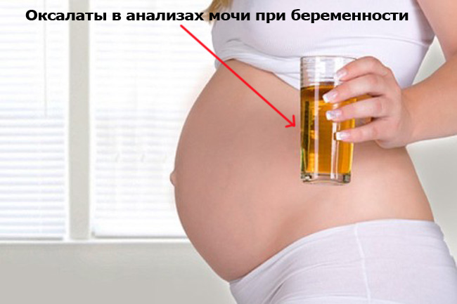 Оксалаты в урине при беременности 
