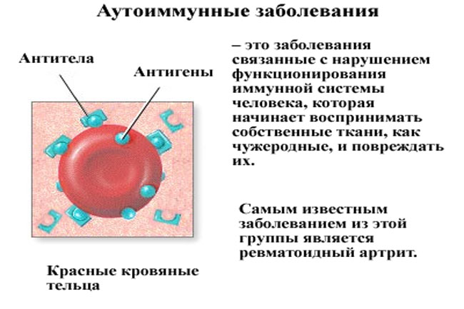 Нарушения в иммунной системе 