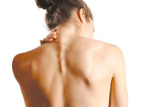 6 советов для профилактики горба на спине и что делать, если он уже есть?