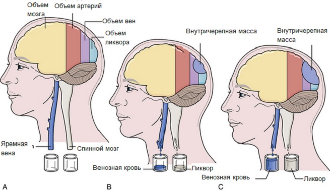 Объем мозга