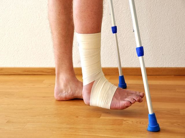 Когда можно наступать на ногу после перелома лодыжки, как долго заживает?