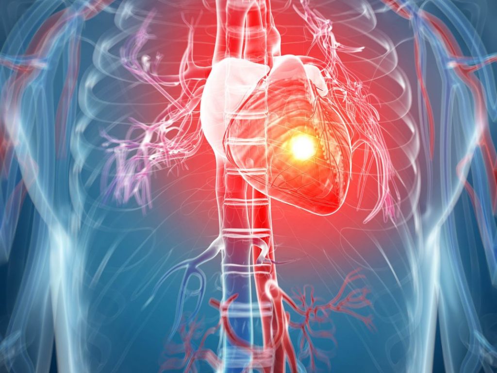 Боль в груди свидетельствует о заболеваниях сердца