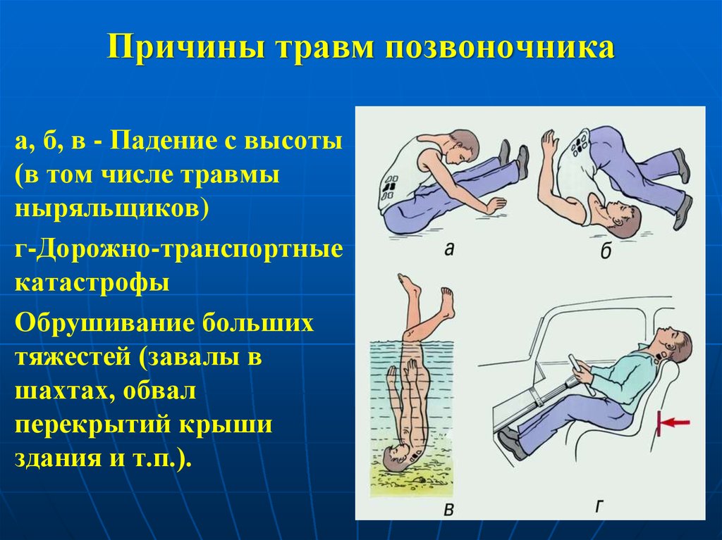 2 вида корсетов при компрессионном переломе спины, как носить. Противопоказания