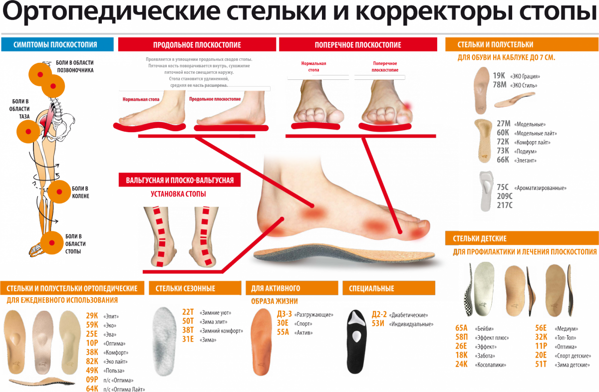 Плоскостопие и обувь