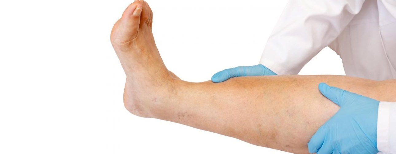 7 причин отека ног, чем и как лучше лечить?