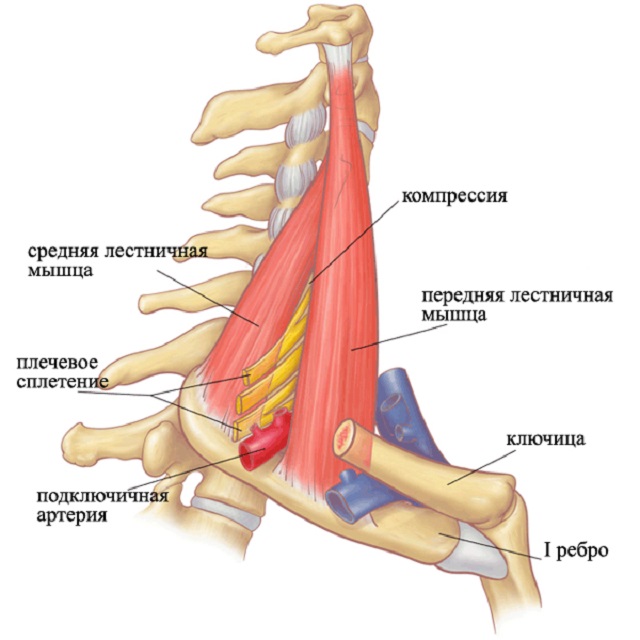 Шейно-плечевой синдром 7 симптомов, лечение и профилактика