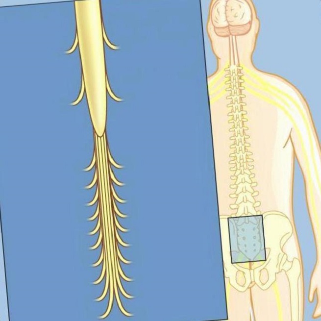 Развитие хвоста у людей. Конский хвост спинного мозга. Нервы конский хвост спинномозговые. Конский хвост нервы.