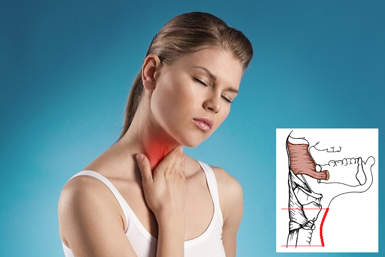 2 причины кома в горле при остеохондрозе шеи. Что делать, если больно глотать?