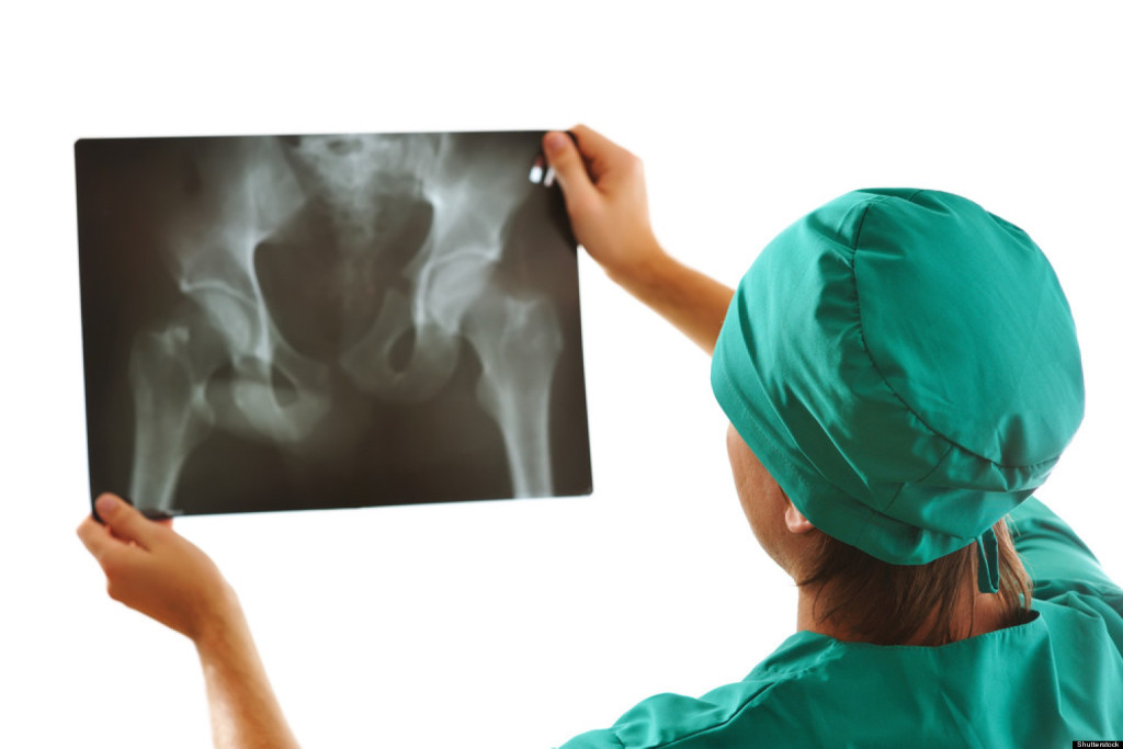 Рентген тазобедренного сустава у детей и взрослых 6 причин назначения