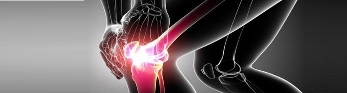6 признаков того что у вас хондроматоз коленного сустава