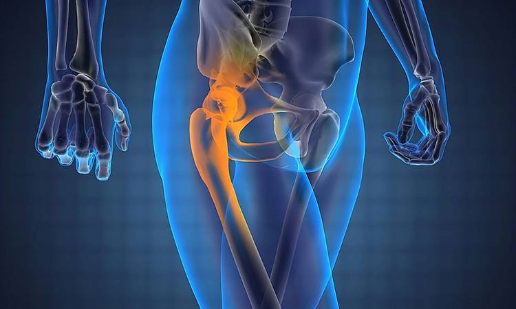 8 причин остеомиелита тазобедренного сустава. Какие последствия?