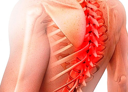 7 методов лечения протрузий грудного отдела