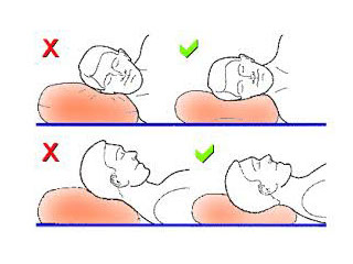 3 позы для сна при шейном остеохондрозе. Как понять, что положение неправильное?
