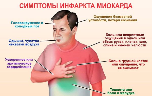 Симптомы инфаркта миокарда