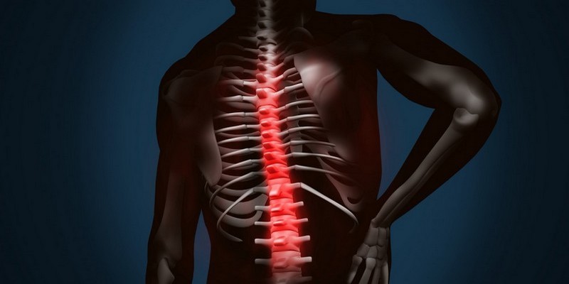 12 причин остеофитов позвоночника (костных наростов) боль в спине может быть из-за этого