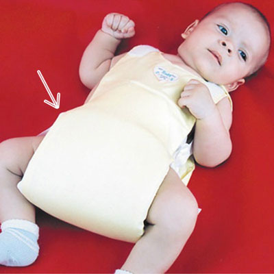Подушка при дисплазии тазобедренных суставов или подушка Фрейка для новорожденных, как использовать?