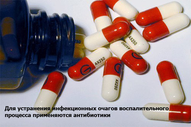 Лечение почек антибиотиками