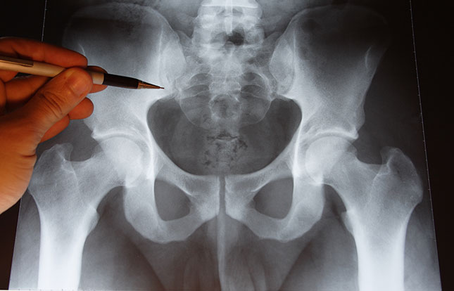 Опасен ли рентген позвоночника? 4 противопоказания, берегите своё здоровье.
