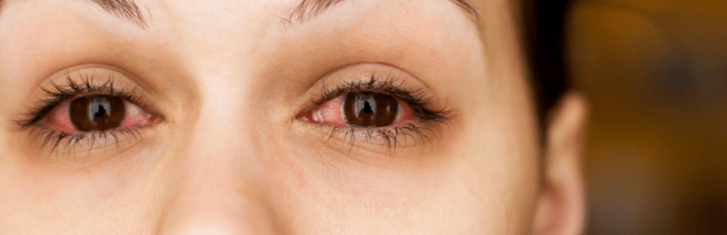 воспаление глазного нерва лечение