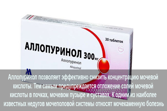 Аллопуринол при мочекаменной болезни