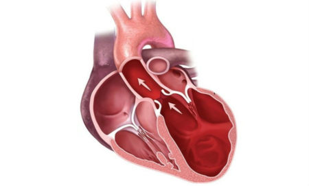 Изменение показателей артериального давления при сердечной недостаточности