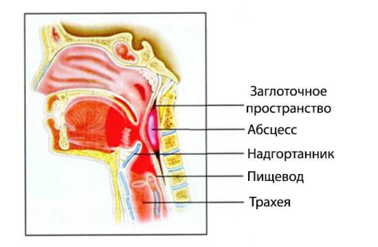 Почему болит шея с правой стороны 11 причин и связь с болезнями