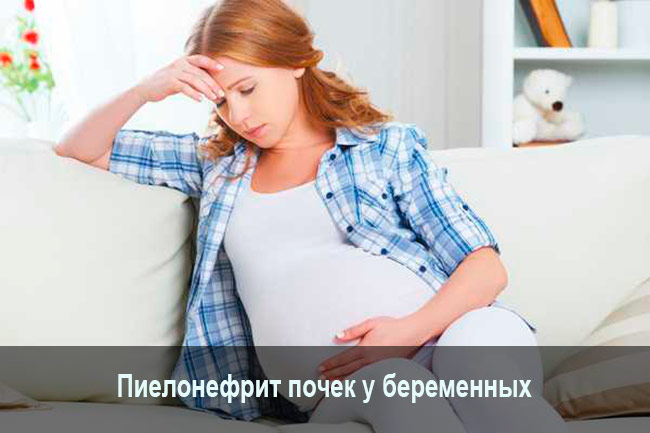 Пиелонефрит почек у беременных