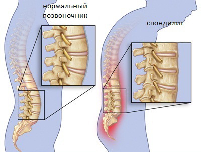 8 основных причин болей в спине как с нею бороться?