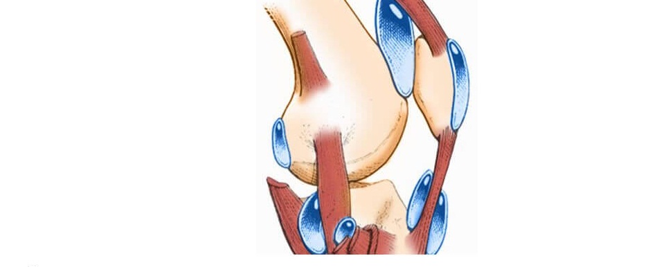 4 причины бурсита коленного сустава обычно и народное лечение, как эффективнее?