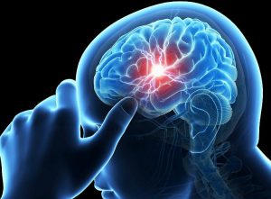 Болит лобная часть головы: каковы причины патологии и как от нее избавиться?