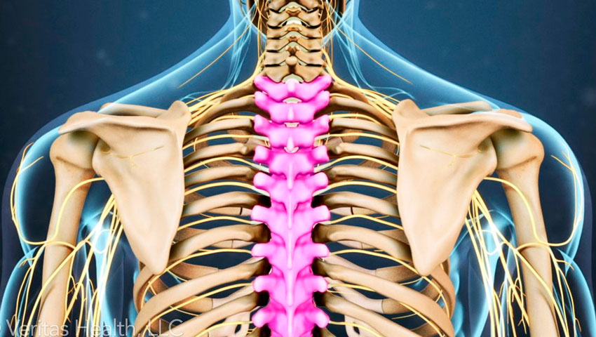 Как определить защемление нерва в грудном отделе. 5 признаков