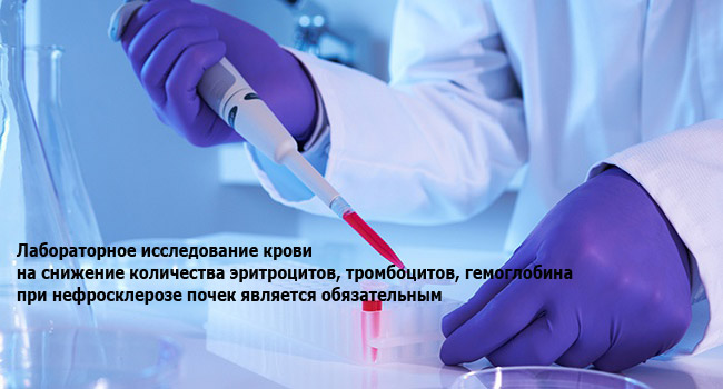Лабораторное исследование крови